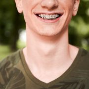 cheerful-young-man-showing-teeth-with-braces