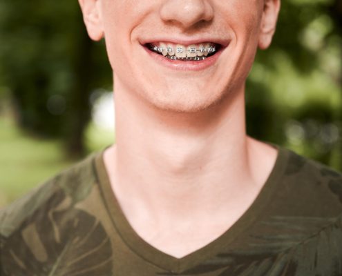 cheerful-young-man-showing-teeth-with-braces