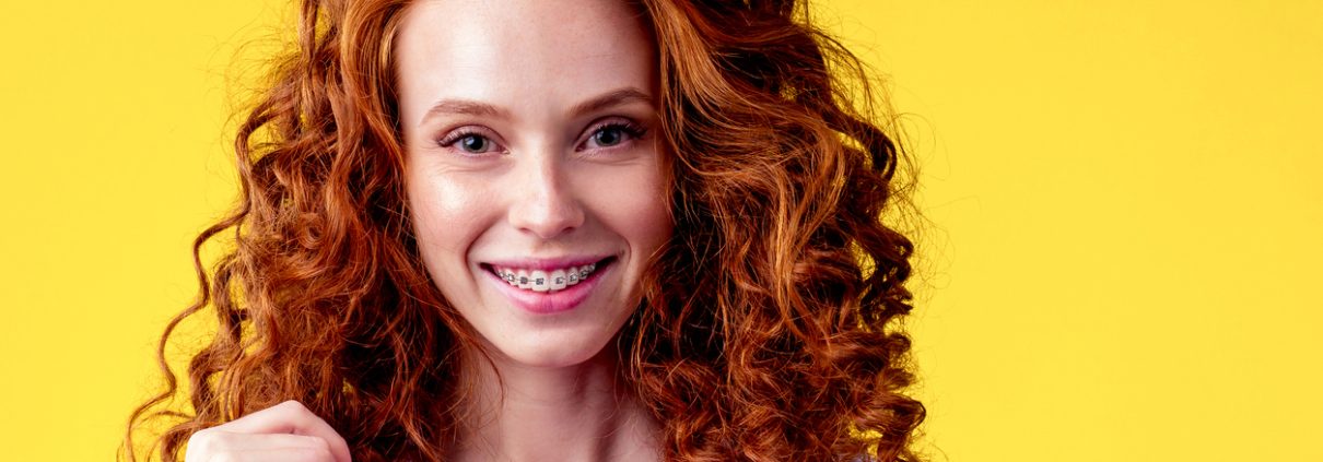 Holistic Vs. Traditional: What's the Right Orthodontic Path for You?